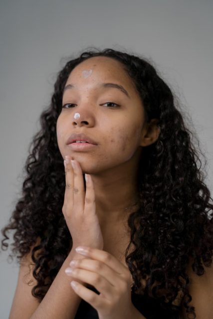 Kvinde der smører creme i ansigtet på hud ramt af psoriasis